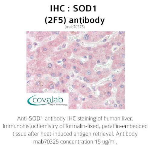 SOD1 (2F5) antibody