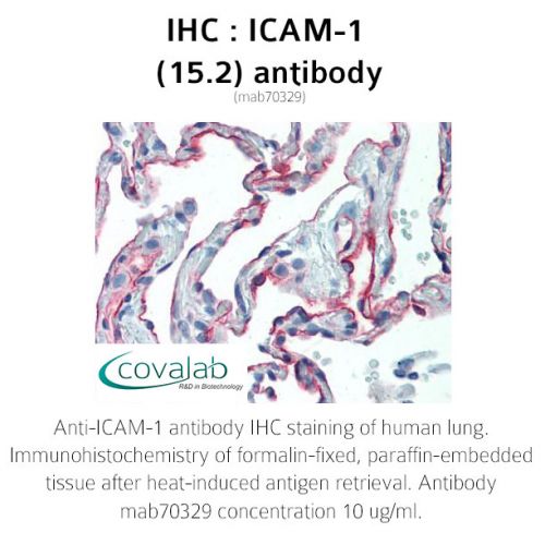 ICAM-1 (15.2) antibody