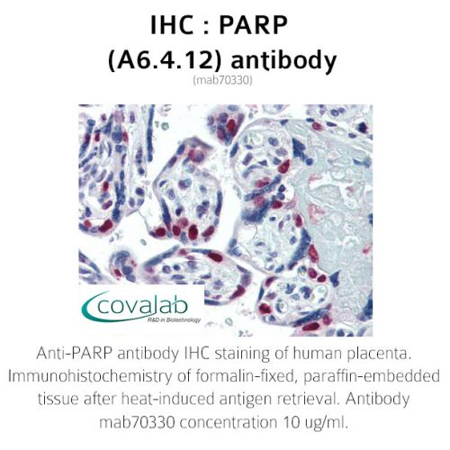 PARP (A6.4.12) antibody