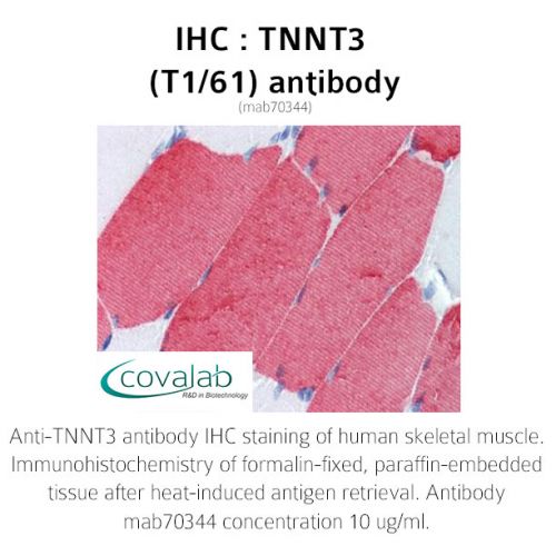 TNNT3 (T1/61) antibody