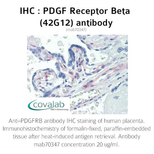 PDGF Receptor Beta (42G12) antibody