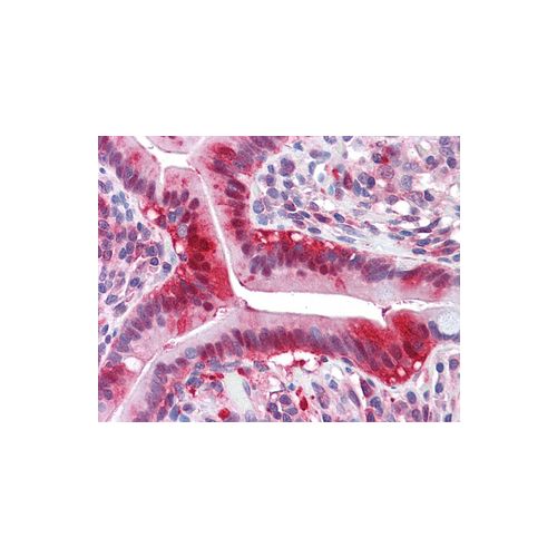 LDHA antibody