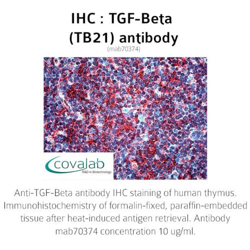 TGF-Beta (TB21) antibody