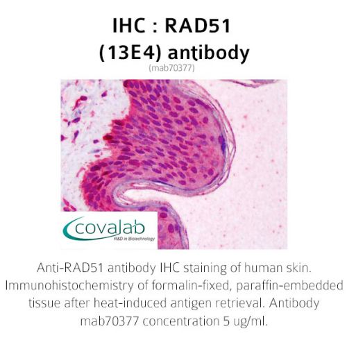 RAD51 (13E4) antibody