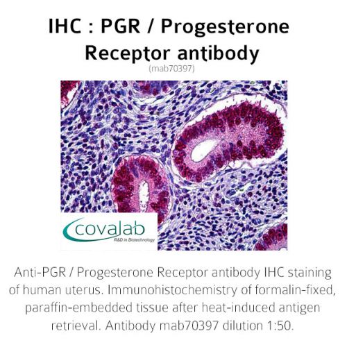 PGR / Progesterone Receptor antibody