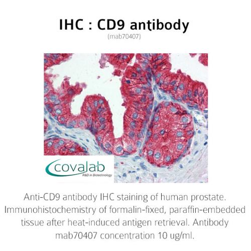 IHC : CD9 antibody<br/>(mab70407)<br/>Anti-CD9 antibody IHC of human prostate. Immunohistochemistry of formalin-fixed, paraffin-embedded tissue after heat-induced antigen retrieval. Antibody concentration 10 µg/ml.