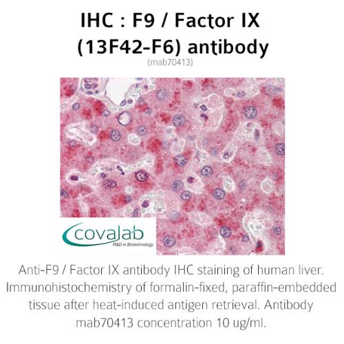 F9 / Factor IX (13F42-F6) antibody