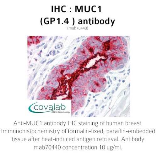 MUC1 (GP1.4 ) antibody