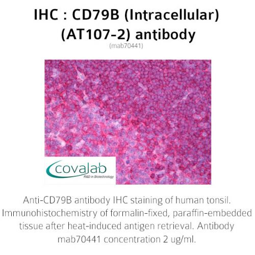 CD79B (Intracellular) (AT107-2) antibody