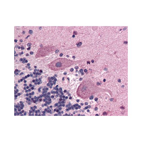 SCN1A / Nav1.1 (N-Terminus) antibody