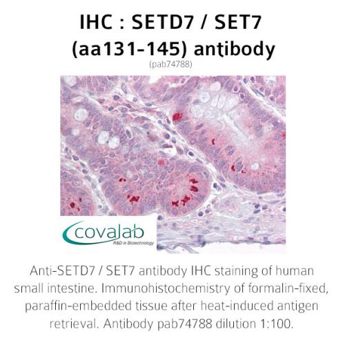 SETD7 / SET7 (aa131-145) antibody