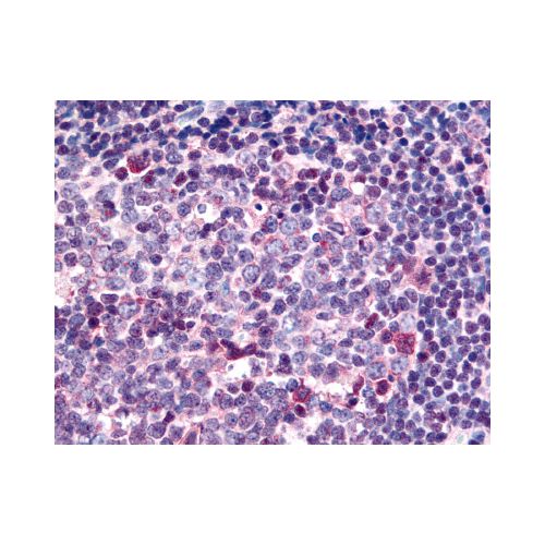 SARM1 / SARM (C-Terminus) antibody