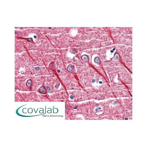 TNFR1 antibody