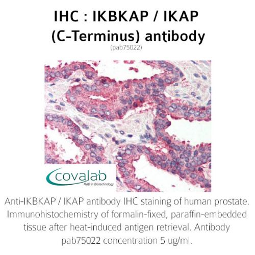 IKBKAP / IKAP (C-Terminus) antibody