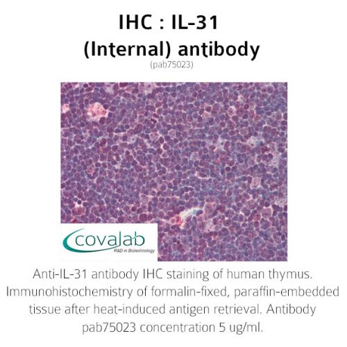 IL-31 (Internal) antibody