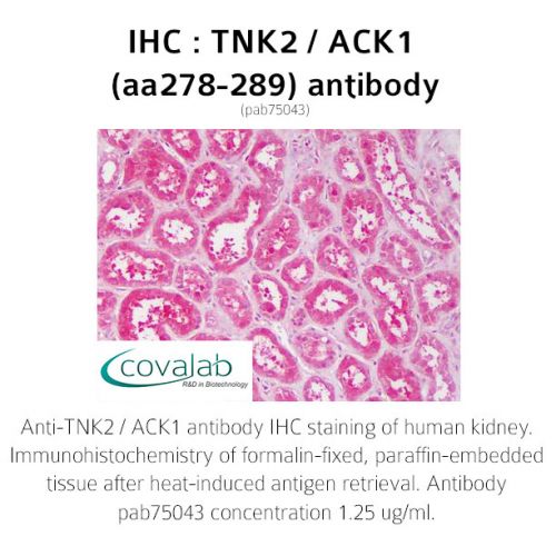 TNK2 / ACK1 (aa278-289) antibody