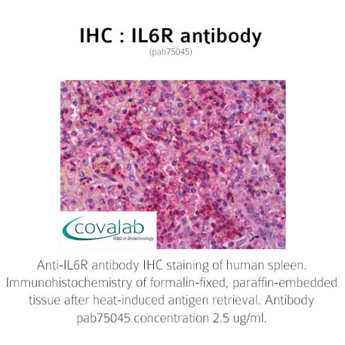 IL6R antibody
