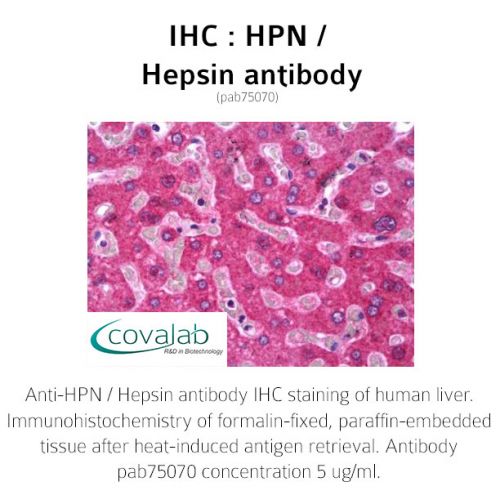 HPN / Hepsin antibody