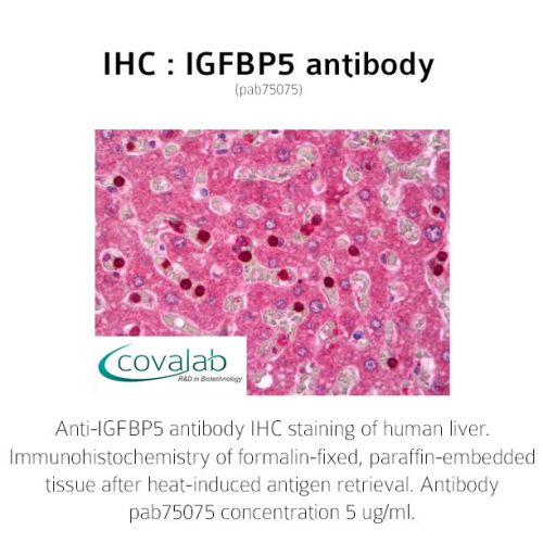 IGFBP5 antibody