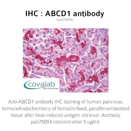 ABCD1 antibody
