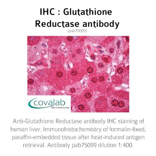 Glutathione Reductase antibody