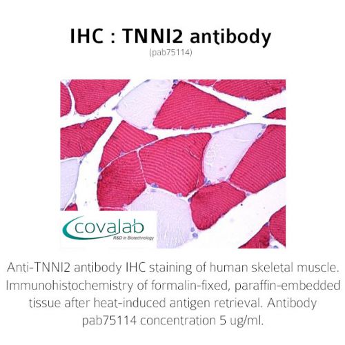 TNNI2 antibody