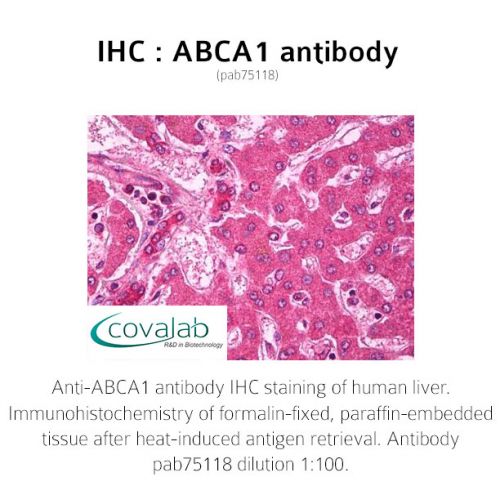 ABCA1 antibody