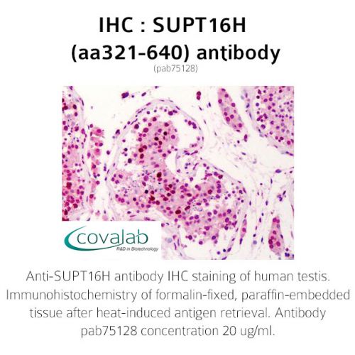 SUPT16H (aa321-640) antibody
