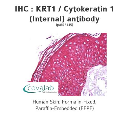 KRT1 / Cytokeratin 1 (Internal) antibody