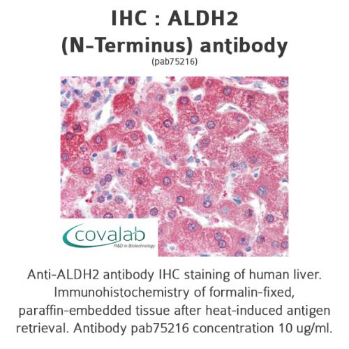 ALDH2 (N-Terminus) antibody