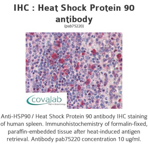 Heat Shock Protein 90 antibody