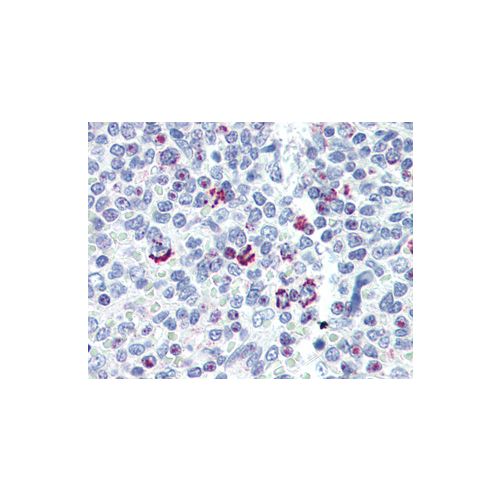 LIN28B (N-Terminus) antibody