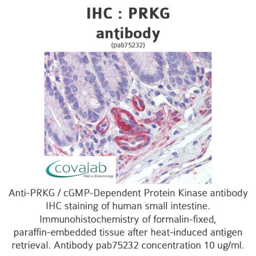 PRKG antibody
