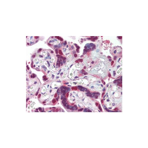 HSP40 antibody