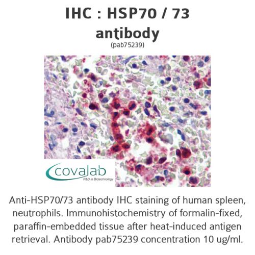 IHC : HSP70/73 antibody<br/>(pab75239)<br/>Anti-HSP70/73 antibody IHC of human spleen, neutrophils. Immunohistochemistry of formalin-fixed, paraffin-embedded tissue after heat-induced antigen retrieval. Antibody concentration 10 µg/ml.