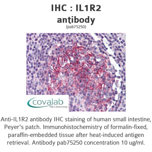 IL1R2 antibody