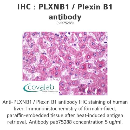 PLXNB1 / Plexin B1 antibody