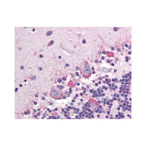 ALPP (H7E8) antibody