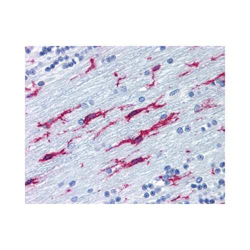 ITGB2 / CD18 (MEM-48) antibody