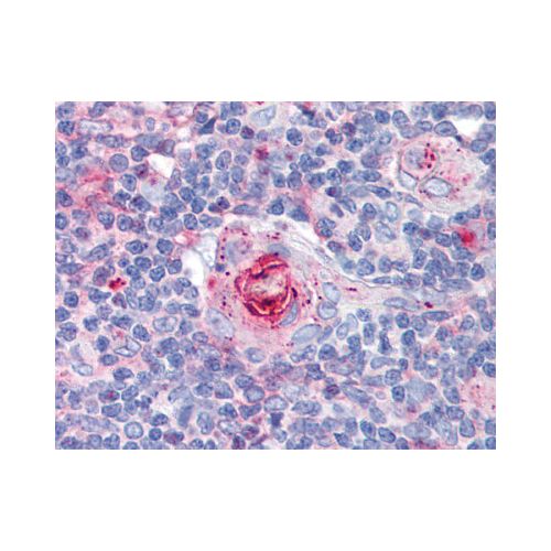 ICAM-1 (MEM-111) antibody