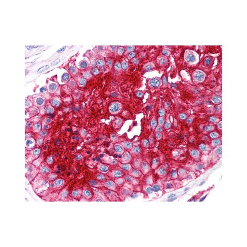 CD147 (MEM-M6/2) antibody