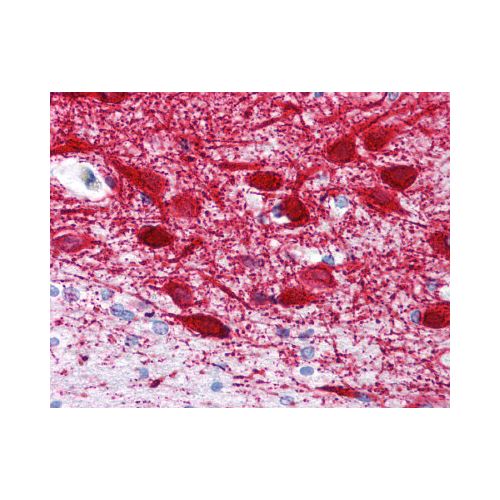MAP2 (MT-08) antibody
