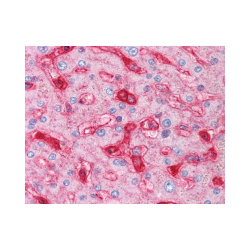 B2M (2213) antibody