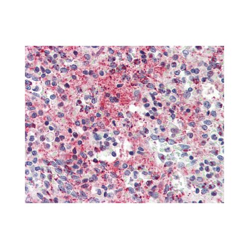 CCL5 / RANTES antibody