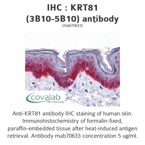 KRT81 (3B10-5B10) antibody