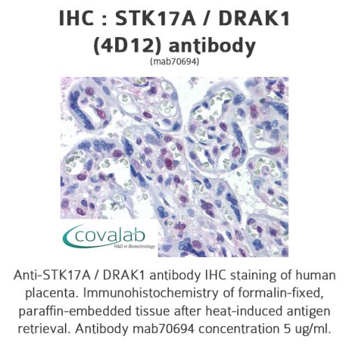 STK17A / DRAK1 (4D12) antibody