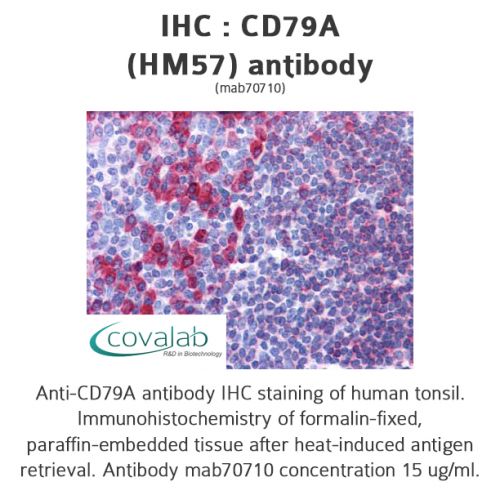 CD79A (HM57) antibody