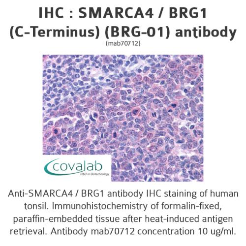 SMARCA4 / BRG1 (C-Terminus) (BRG-01) antibody