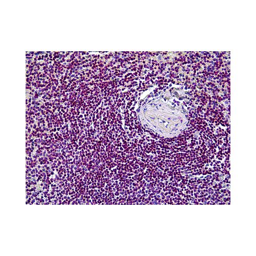 CDK6 (8H4) antibody