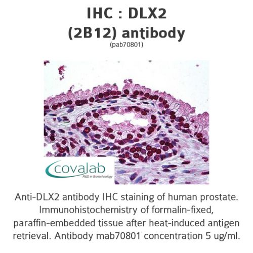DLX2 (2B12) antibody